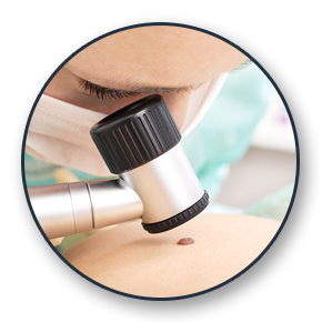 Melanoma Sarcoma