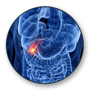 Gallbladder Cancer